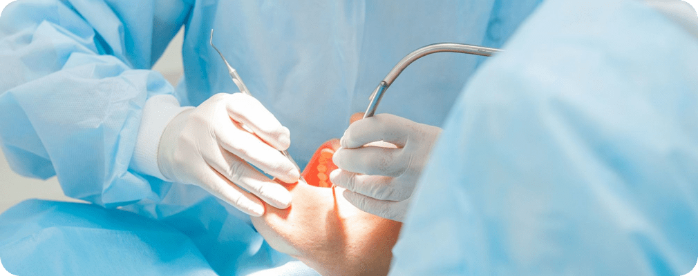 Conseils post-opératoires après une intervention de Chirurgie Muco-gingivale