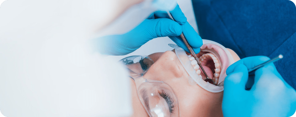 Conseils post-opératoires après une intervention de Chirurgie Orale