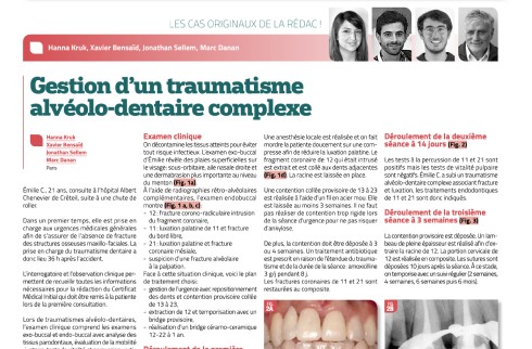 Dr Stéphane Beal implants à Vincennes